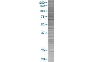 IL18R1 transfected lysate. (IL18R1 293T Cell Transient Overexpression Lysate(Denatured))