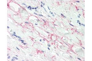 Anti-MFAP4 antibody IHC staining of human tonsil, collagenous stroma.