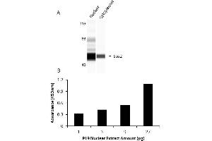 Transcription factor activity assay of SOX2 from nuclear extracts of P19 cells. (SOX2 Kit ELISA)