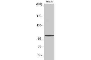 Western Blotting (WB) image for anti-Nuclear Factor of kappa Light Polypeptide Gene Enhancer in B-Cells 1 (NFKB1) (Thr145) antibody (ABIN3180205) (NFKB1 anticorps  (Thr145))