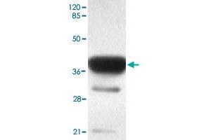 Western blot analysis of ACSS1 monoclonal antibody  at 1 : 2000 dilution interacts with recombinant ACSS1 protein with a GST tag. (ACSS1 anticorps  (C-Term))