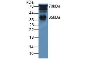 Figure. (PTF1A anticorps  (AA 177-328))