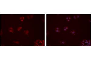 ABIN6277354 staining Hela cells by IF/ICC. (CX3CR1 anticorps  (N-Term))