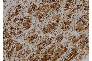 ABIN6275179 at 1/100 staining Human kidney tissue by IHC-P. (GNB5 anticorps  (Internal Region))