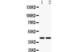 Anti- CD244 antibody, Western blotting All lanes: Anti CD244  at 0. (2B4 anticorps  (C-Term))