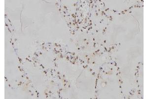 ABIN6277167 at 1/100 staining Human lung tissue by IHC-P. (PPP2R2A anticorps  (Internal Region))