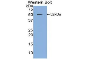 Western blot analysis of the recombinant protein. (FGL2 anticorps  (AA 24-439))