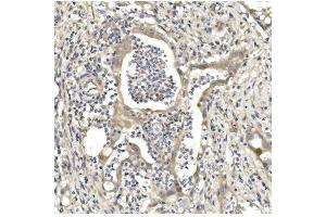 IHC analysis of Aconitase 1/ACO1 using anti-Aconitase 1/ACO1 antibody (ABIN7598988). (Aconitase 1 anticorps  (AA 1-137))