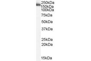 ABIN185642 (2µg/ml) staining of Human Liver lysate (35µg protein in RIPA buffer). (MYO9B anticorps  (Internal Region))