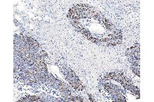 IHC analysis of CHCHD10 using anti-CHCHD10 antibody (ABIN7602507). (CHCHD10 anticorps  (AA 80-142))