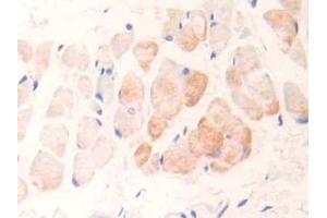 Detection of cTnI in Rat Skin Tissue using Polyclonal Antibody to Cardiac Troponin I (cTnI) (TNNI3 anticorps  (AA 1-211))