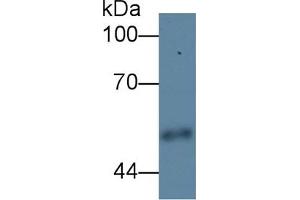 Detection of CPE in Human Urine using Polyclonal Antibody to Carboxypeptidase E (CPE) (CPE anticorps  (AA 318-476))