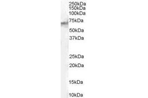 ABIN185613 (1µg/ml) staining of Human Spleen lysate (35µg protein in RIPA buffer). (STAM2 anticorps  (Internal Region))