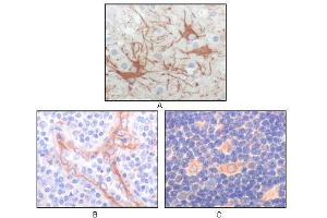 Immunohistochemical analysis of paraffin-embedded human cerebrum tumor (A), endothelium of vessel (B), lymphocyte of thymus(C), showing cytoplasmic localization using FES mouse mAb with DAB staining. (FES anticorps  (AA 613-822))
