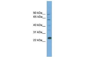 WB Suggested Anti-BCL7A Antibody Titration: 0. (BCL7A anticorps  (Middle Region))