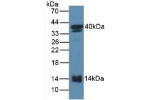 Detection of SAA2 in Mouse Serum using Polyclonal Antibody to Serum Amyloid A2 (SAA2) (SAA2 anticorps  (AA 20-122))