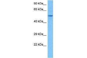 Host:  Rat  Target Name:  HNF4A  Sample Tissue:  Rat Skeletal Muscle  Antibody Dilution:  1ug/ml (HNF4A anticorps  (Middle Region))