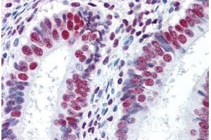 Human Uterus: Formalin-Fixed, Paraffin-Embedded (FFPE)