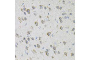 Immunohistochemistry of paraffin-embedded mouse brain using CDA Antibody (ABIN6291347) at dilution of 1:100 (40x lens). (CDA anticorps)
