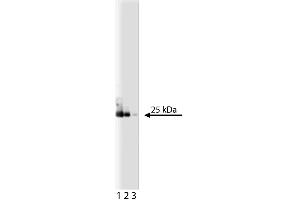 Western blot analysis of eIF-4E on a A431 lysate. (EIF4E anticorps  (AA 1-217))