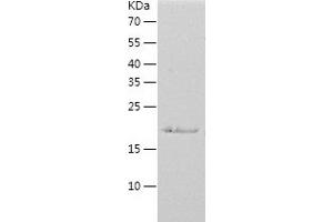 Western Blotting (WB) image for Eukaryotic Translation Initiation Factor 3 Subunit J (EIF3S1) (AA 70-258) protein (His-IF2DI Tag) (ABIN7122844)