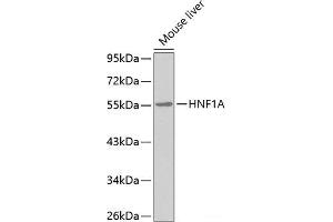 Western blot analysis of extracts of Mouse liver using HNF1A Polyclonal Antibody. (HNF1A anticorps)