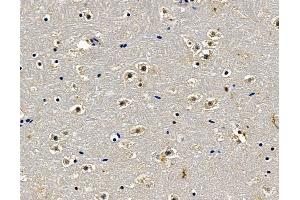 ABIN7096817 and ABIN7100883 at 1/100 staining mouse brain tissue by IHC-P.