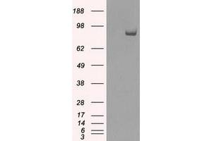 HEK293T cells were transfected with the pCMV6-ENTRY control (Left lane) or pCMV6-ENTRY SATB1 (Right lane) cDNA for 48 hrs and lysed. (SATB1 anticorps)