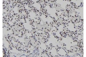 ABIN6277939 at 1/100 staining Rat lung tissue by IHC-P. (T-Bet anticorps  (Internal Region))