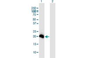 Western Blot analysis of N6AMT1 expression in transfected 293T cell line ( H00029104-T01 ) by N6AMT1 MaxPab polyclonal antibody. (N6AMT1 anticorps  (AA 1-186))