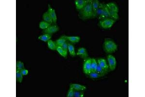 Immunofluorescent analysis of HepG2 cells using ABIN7150898 at dilution of 1:100 and Alexa Fluor 488-congugated AffiniPure Goat Anti-Rabbit IgG(H+L) (TCTE1 anticorps  (AA 285-501))