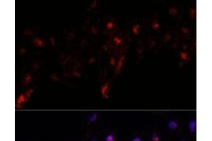 Immunofluorescence analysis of L929 cells using PEX10 Polyclonal Antibody at dilution of 1:100. (PEX10 anticorps)