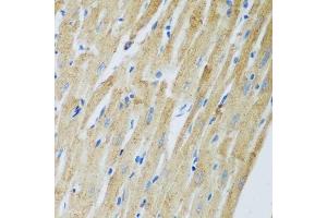 Immunohistochemistry of paraffin-embedded rat heart using ADAM12 antibody.