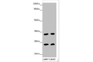 Western blot All lanes: MRAS antibody at 3. (MRAS anticorps  (AA 79-208))