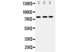 Anti-DDX4/MVH antibody, Western blotting Lane 1: Rat Testis Tissue Lysate Lane 2: Mouse Testis Tissue Lysate Lane 3: Mouse Ovary Tissue Lysate