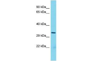 Host: Rabbit Target Name: Rpf2 Sample Type: Rat Spleen lysates Antibody Dilution: 1. (RPF2 anticorps  (N-Term))