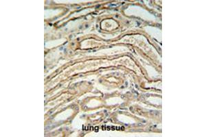 ADH7 Antibody (C-Term) IHC analysis in formalin fixed and paraffin embedded lung tissue followed by peroxidase conjugation of the secondary antibody and DAB staining.