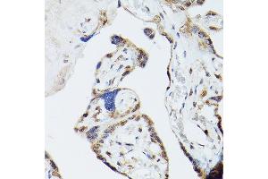 Immunohistochemistry of paraffin-embedded human placenta using ADK Rabbit pAb (ABIN7265463) at dilution of 1:300 (40x lens). (ADK anticorps  (AA 200-345))