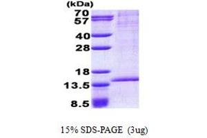 SDS-PAGE (SDS) image for RAB8B, Member RAS Oncogene Family (RAB8B) (AA 1-204) protein (His tag) (ABIN5853051)