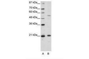 Image no. 1 for anti-Zinc Finger and SCAN Domain Containing 20 (ZSCAN20) (N-Term) antibody (ABIN203137) (ZSCAN20 anticorps  (N-Term))