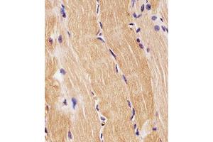 (ABIN1881685 and ABIN2842377) staining PRODH in H.