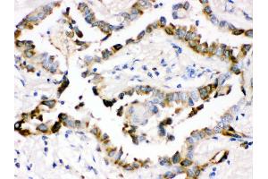 Immunohistochemistry (Paraffin-embedded Sections) (IHC (p)) image for anti-Surfactant Protein D (SFTPD) (AA 292-321), (C-Term) antibody (ABIN3043335) (SFTPD anticorps  (C-Term))