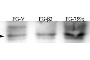FG pancreatic carcinoma cell lines stably expressing vector alone (FG-V), the b3 integrin subunit (FG-b3), or a b3 truncation mutant (FG-759x) probed with phospho-Src antibody.