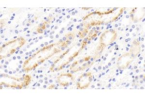 Detection of MMP13 in Rabbit Kidney Tissue using Polyclonal Antibody to Matrix Metalloproteinase 13 (MMP13)