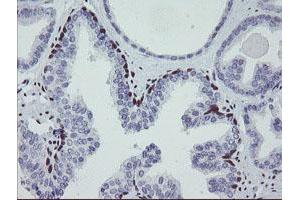 Image no. 8 for anti-Meis Homeobox 3 (MEIS3) (AA 1-261) antibody (ABIN1490671) (MEIS3 anticorps  (AA 1-261))