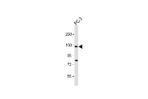 All lanes : Anti-TR Antibody (C-term ) at 1:1000 dilution Lane 1: PC-3 whole cell lysate Lysates/proteins at 20 μg per lane. (TRPM8 anticorps  (C-Term))