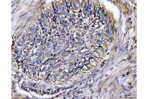IHC analysis of BIN1 using anti-BIN1 antibody (ABIN7601780).