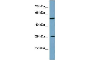 Host: Rabbit Target Name: DKK1 Sample Type: PANC1 Whole Cell lysates Antibody Dilution: 1. (DKK1 anticorps  (C-Term))