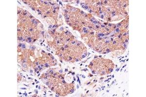 Immunohistochemical analysis of paraffin-embedded human stomach using Pink1 antibody at 1:25 dilution.