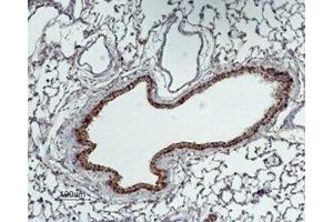 Expression of GABA transporter 2 in rat lung - Immunohistochemical staining of rat lung paraffin-embedded sections using Anti-GABA Transporter 2 (GAT-2) Antibody (ABIN7043743, ABIN7044461 and ABIN7044462), (1:100).